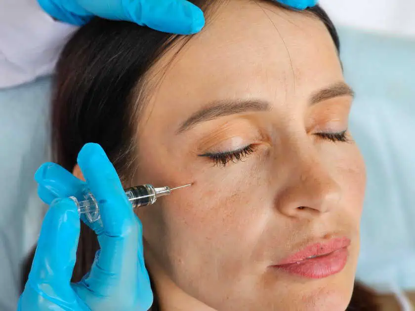 Dermal Fillers for Treating Nasolabial Folds in Orefield, PA by Sorelle Aesthetics