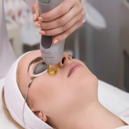 RF Microneedling